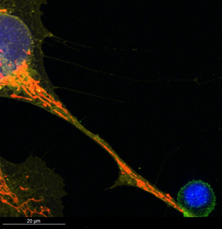 Cells Are Swapping Their Mitochondria: What Does This Mean for Our Health? Cells Are Swapping Their Mitochondria: What Does This Mean for Our Health? - Mitochondria, once thought to be static cellular powerhouses, are now known to travel between cells. Researchers explore how this 'mitochondrial transfer' could heal tissues—or be exploited by diseases like cancer.