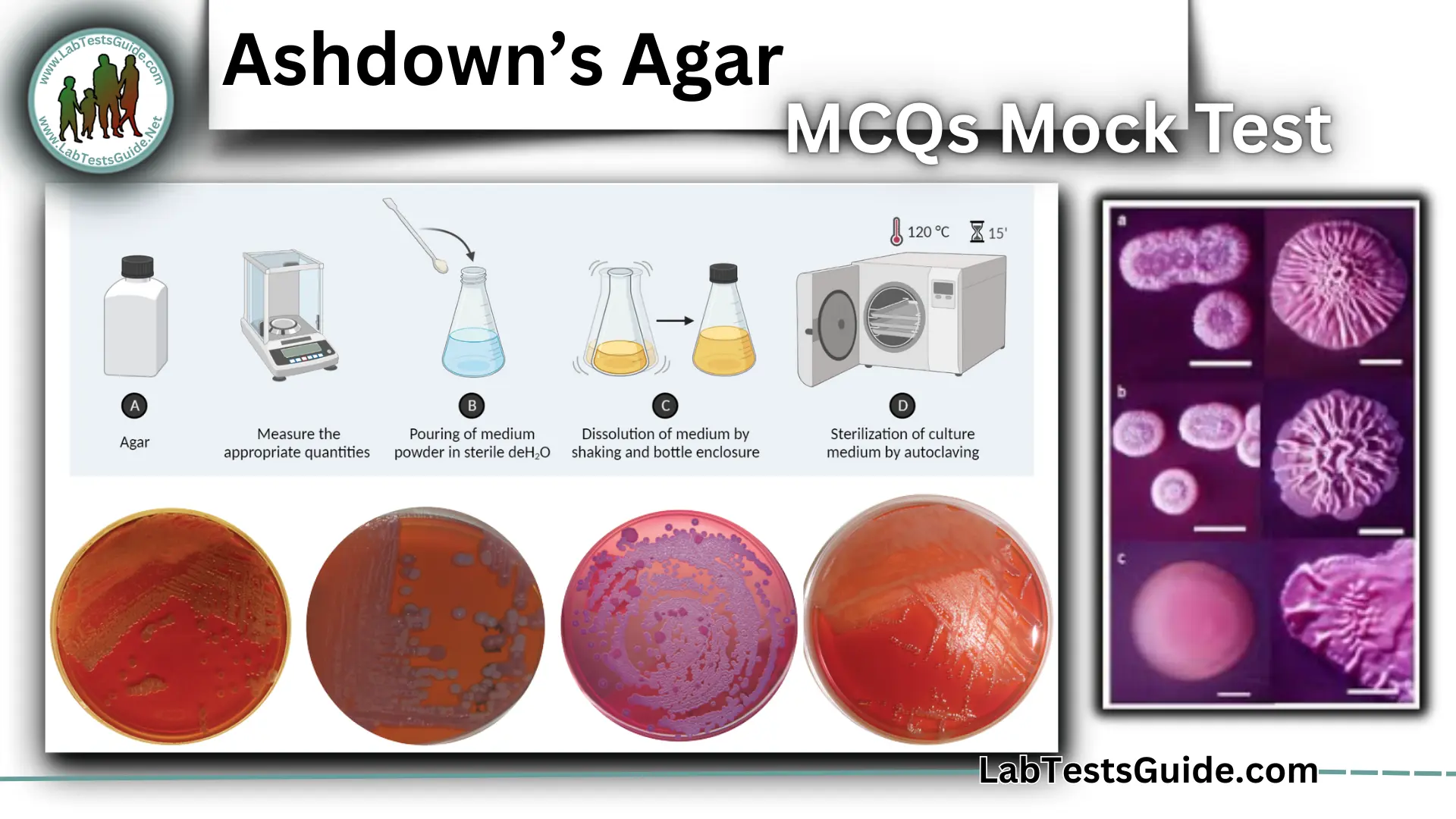 Ashdown’s Agar MCQs Mock Test