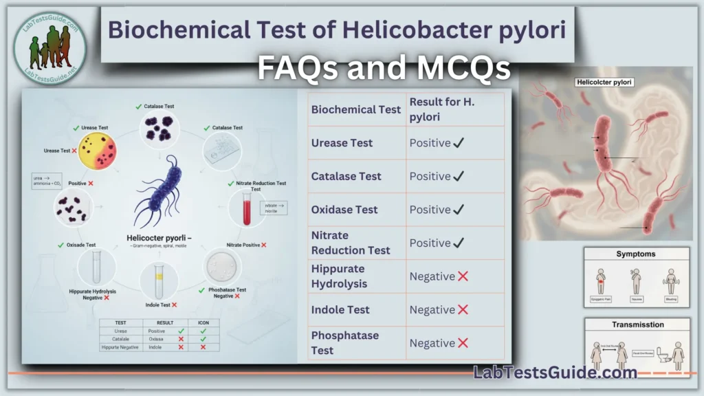 Biochemical Test of Helicobacter pylori FAQs and MCQs