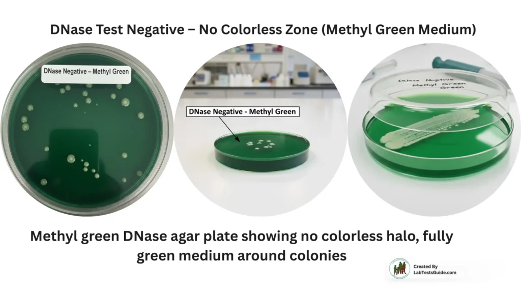 DNase Test Negative – NO Colorless Zone (Methyl Green Medium)