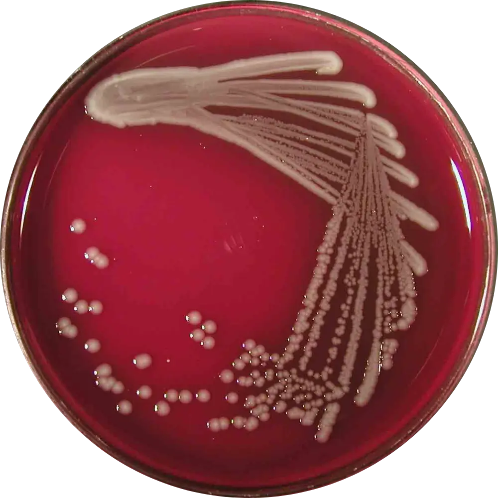 E Coli on Blood Agar