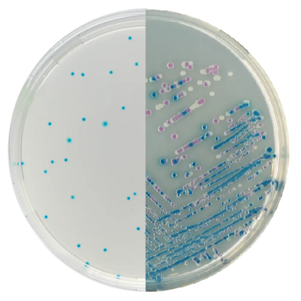 E Coli on CHROMagar Agar