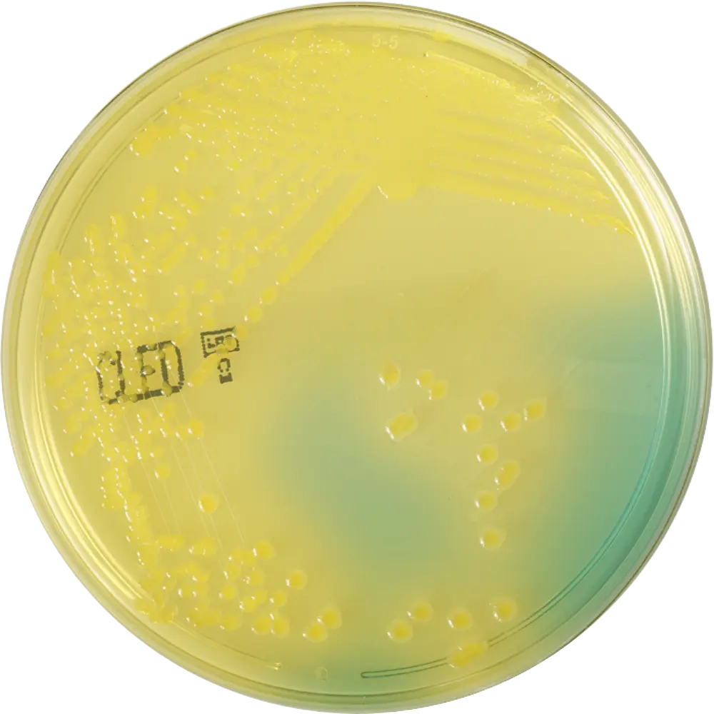 E Coli on CLED Agar