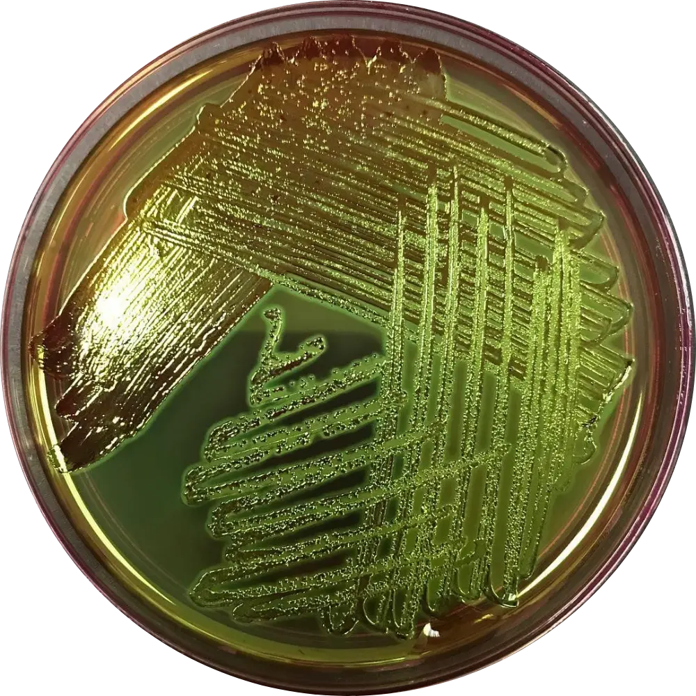 E Coli on EMB Agar