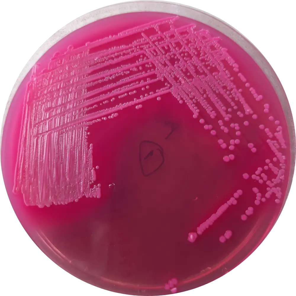 E Coli on MacConkey (MAC) Agar