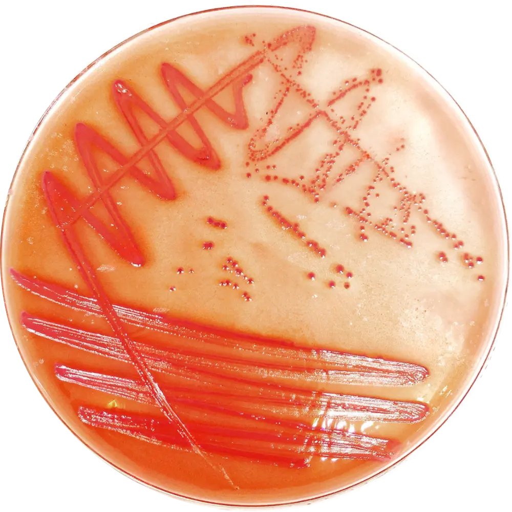 E Coli on SS and HE Agar