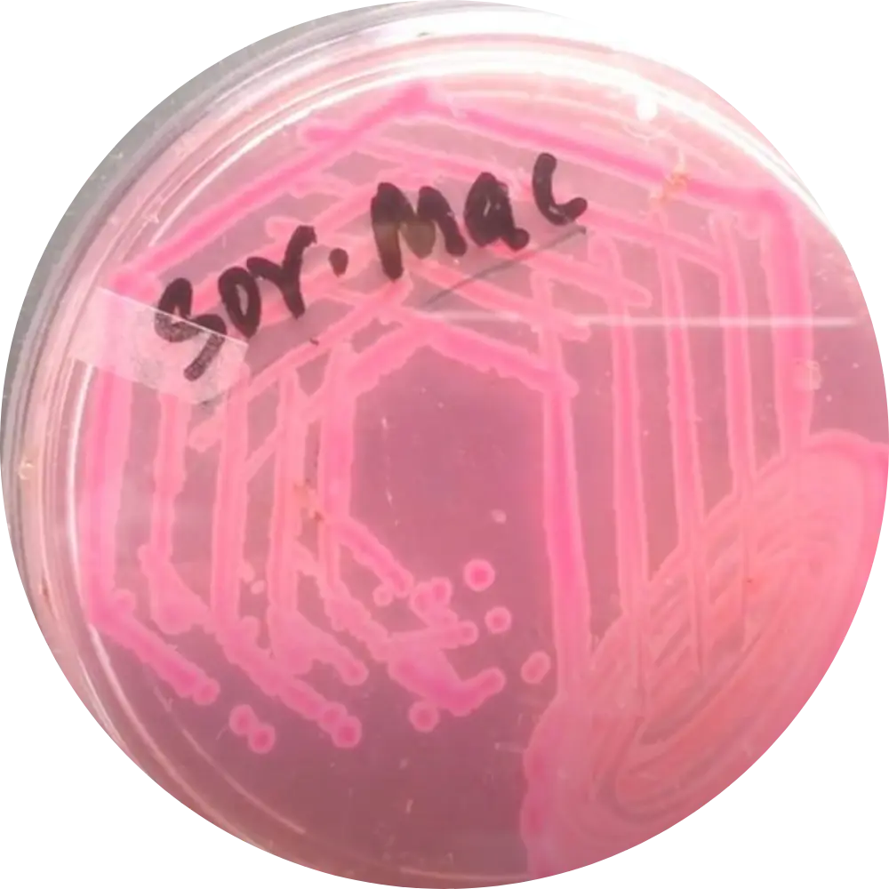 E Coli on  Sorbitol MAC (SMAC)