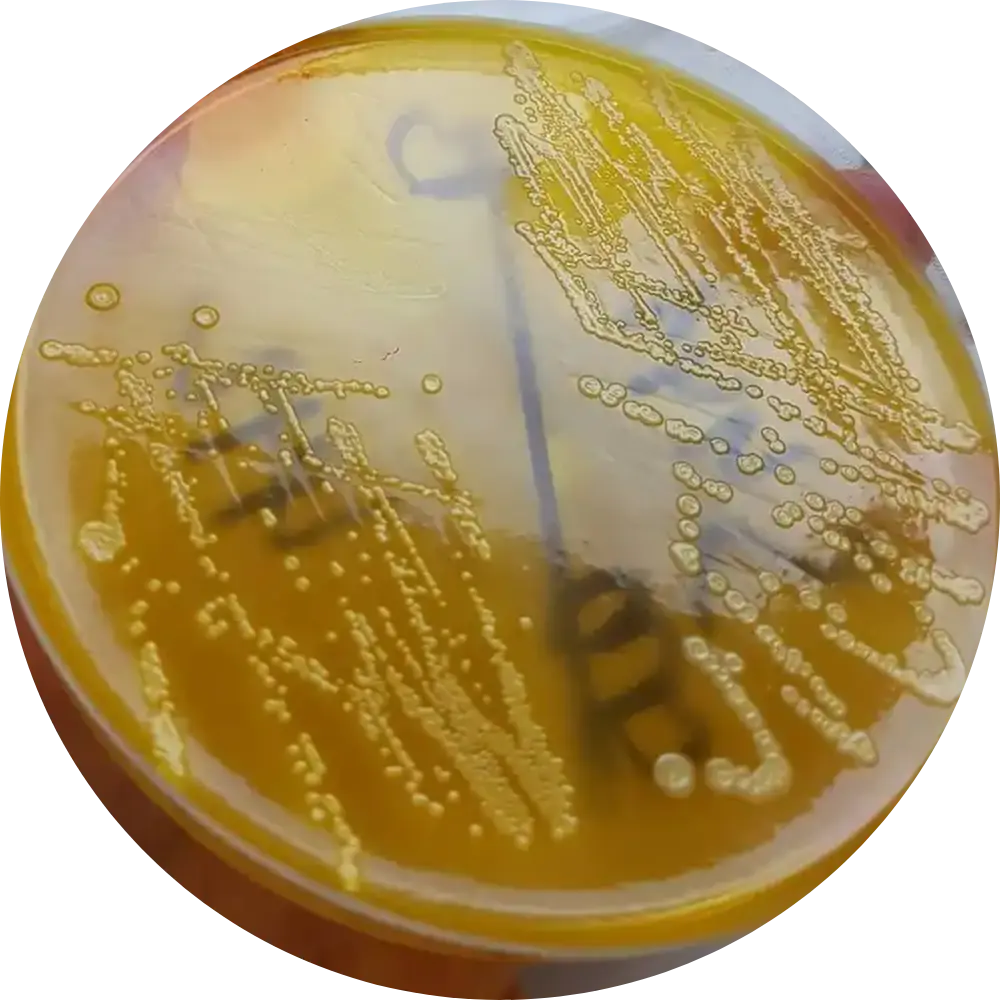 E Coli on XLD Agar