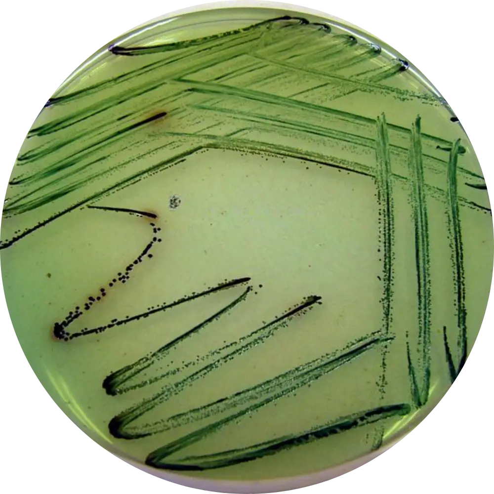 Salmonella on Bismuth Sulfite Agar (BSA) Agar