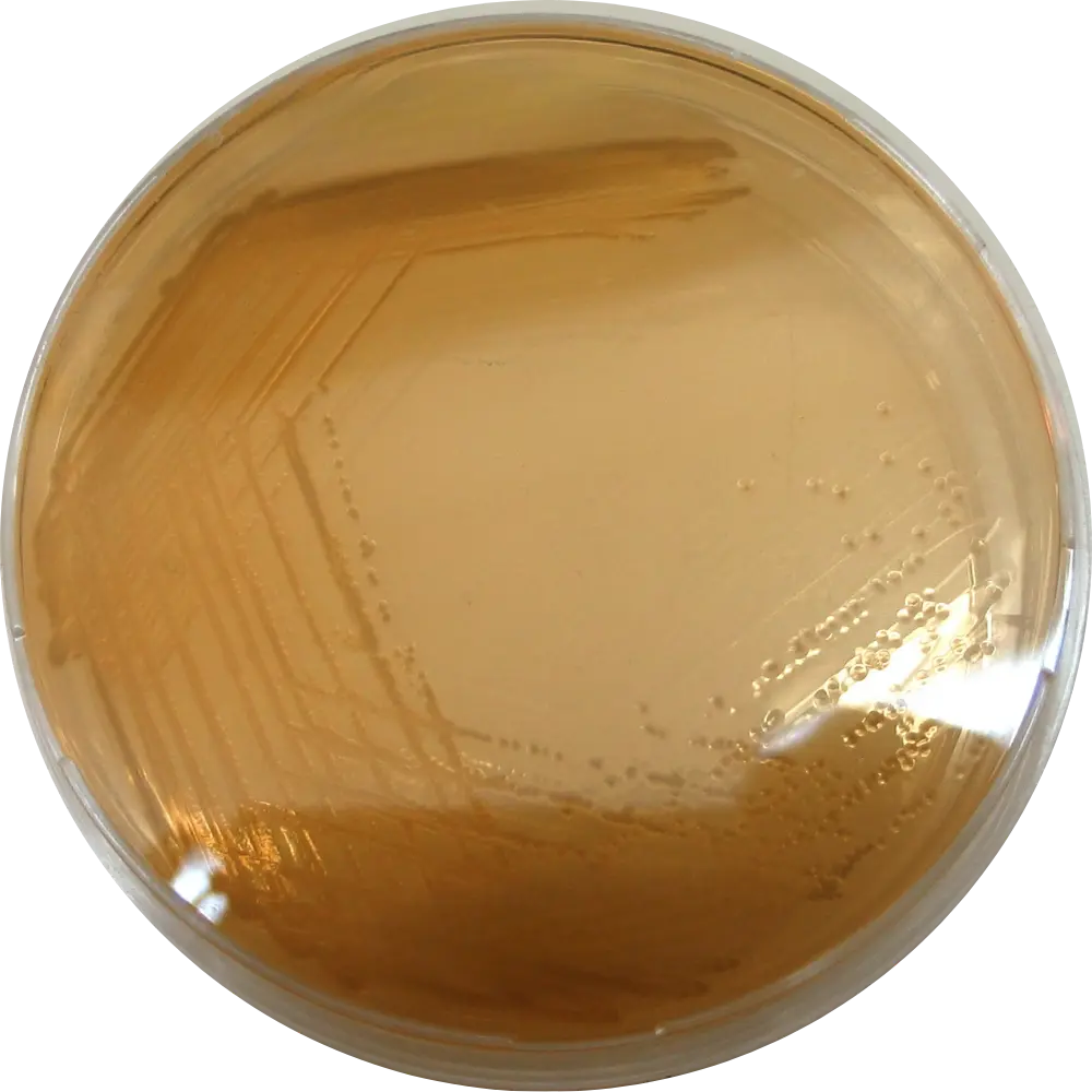 Salmonella on Deoxycholate Citrate (DCA) Agar