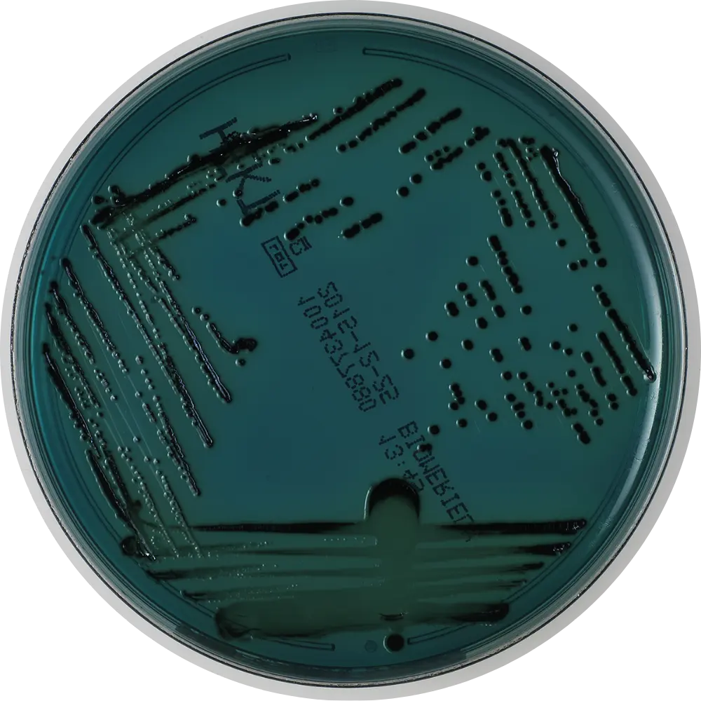 Salmonella on Hektoen Enteric (HE) Agar (BSA) Agar