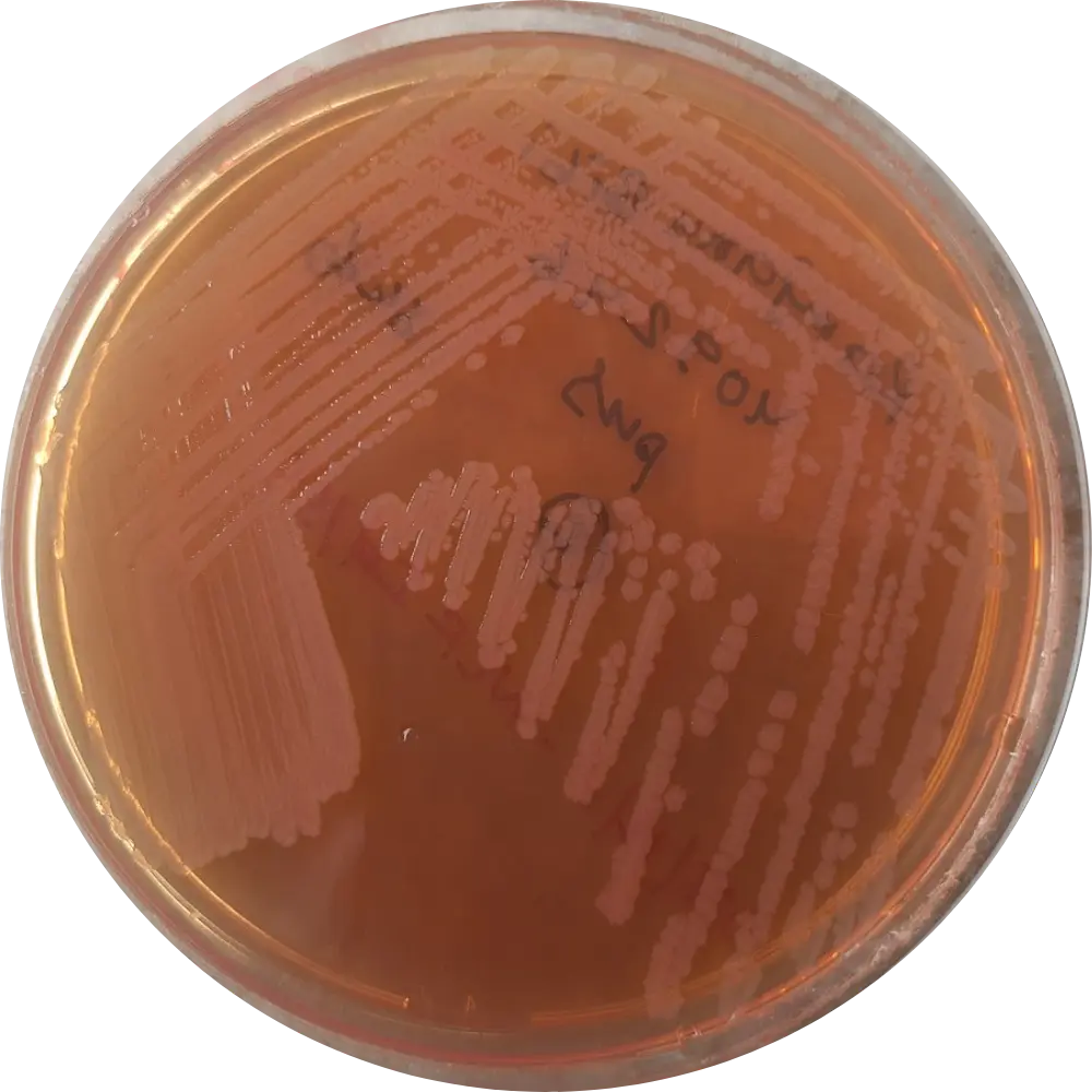 Salmonella on MacConkey (MAC) Agar