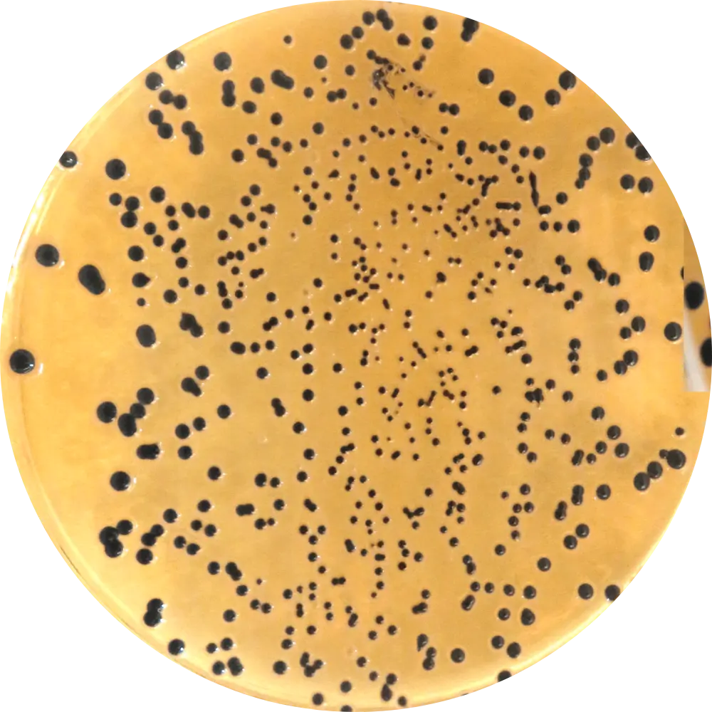 Salmonella on Salmonella-Shigella (SS) Agar