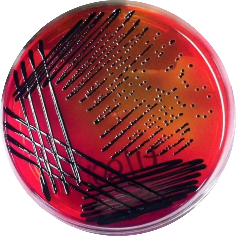 Salmonella on XLD Agar