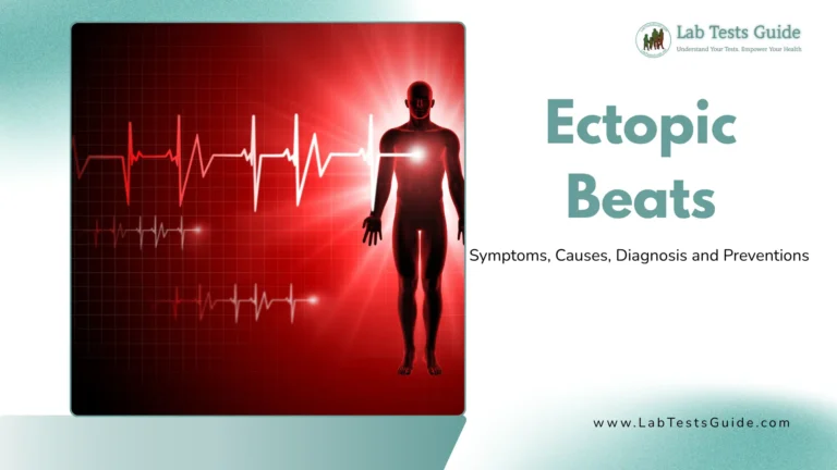 Ectopic Beats