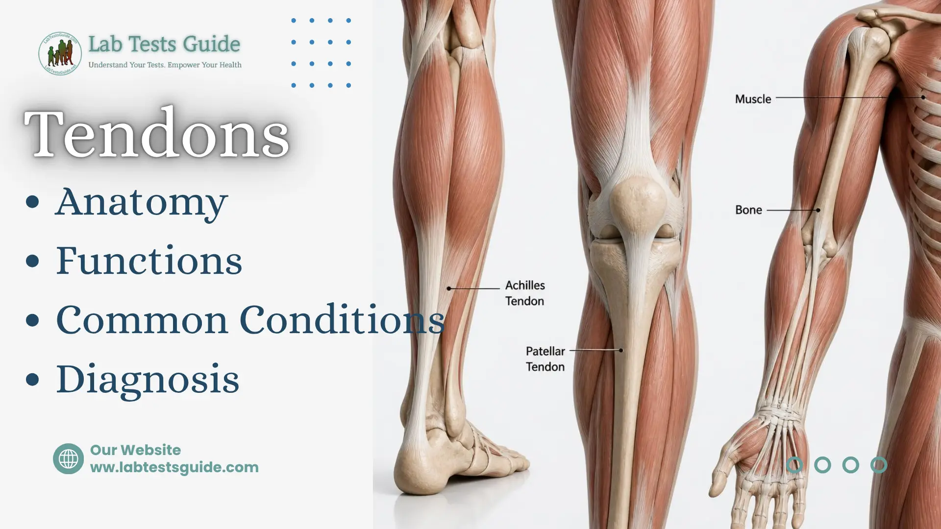 Tendon anatomy showing the Achilles tendon, patellar tendon, muscles, and bones