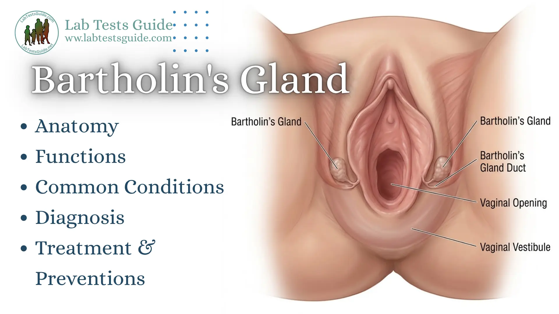 Bartholin's Gland Anatomy, Functions & Common Conditions Bartholin's gland anatomy showing the glands, ducts, vaginal opening, and vaginal vestibule